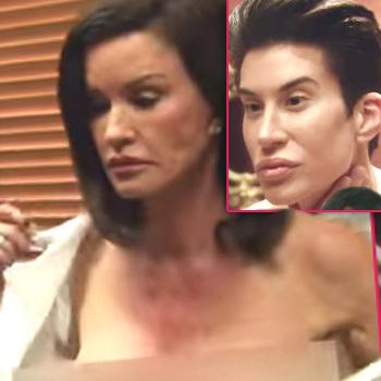 //botched e tv show fix hollywood worst plastic surgery cases sq copy