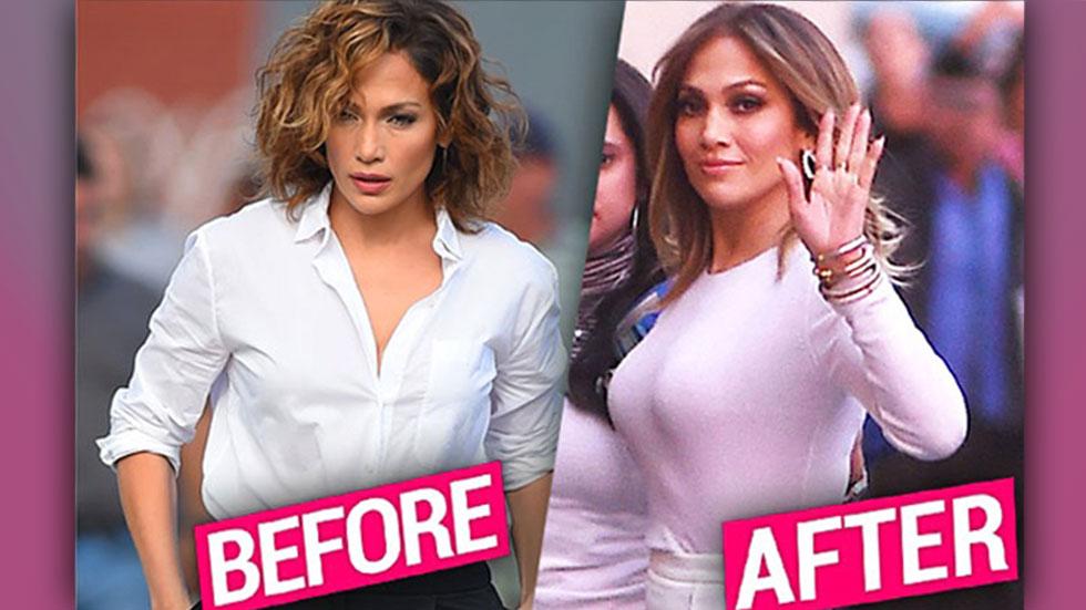 Jennifer Lopez S Plastic Surgery Exposed — Top Doc Weighs In On Possible Boob Job