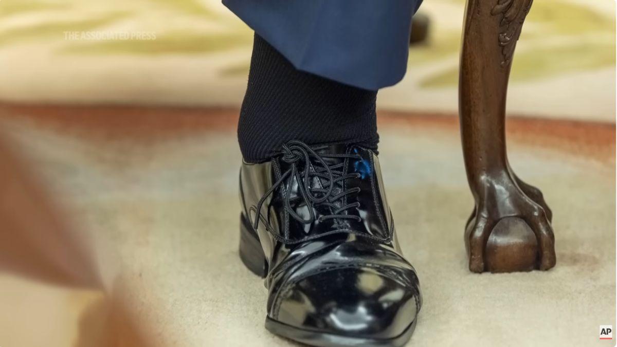 Photo of Trump's swollen ankles