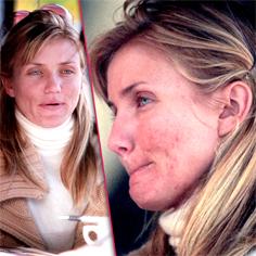//cameron diaz talks acne problem sq