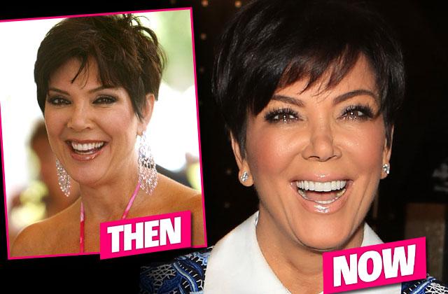 Kris Jenner Nose Job Collapsing