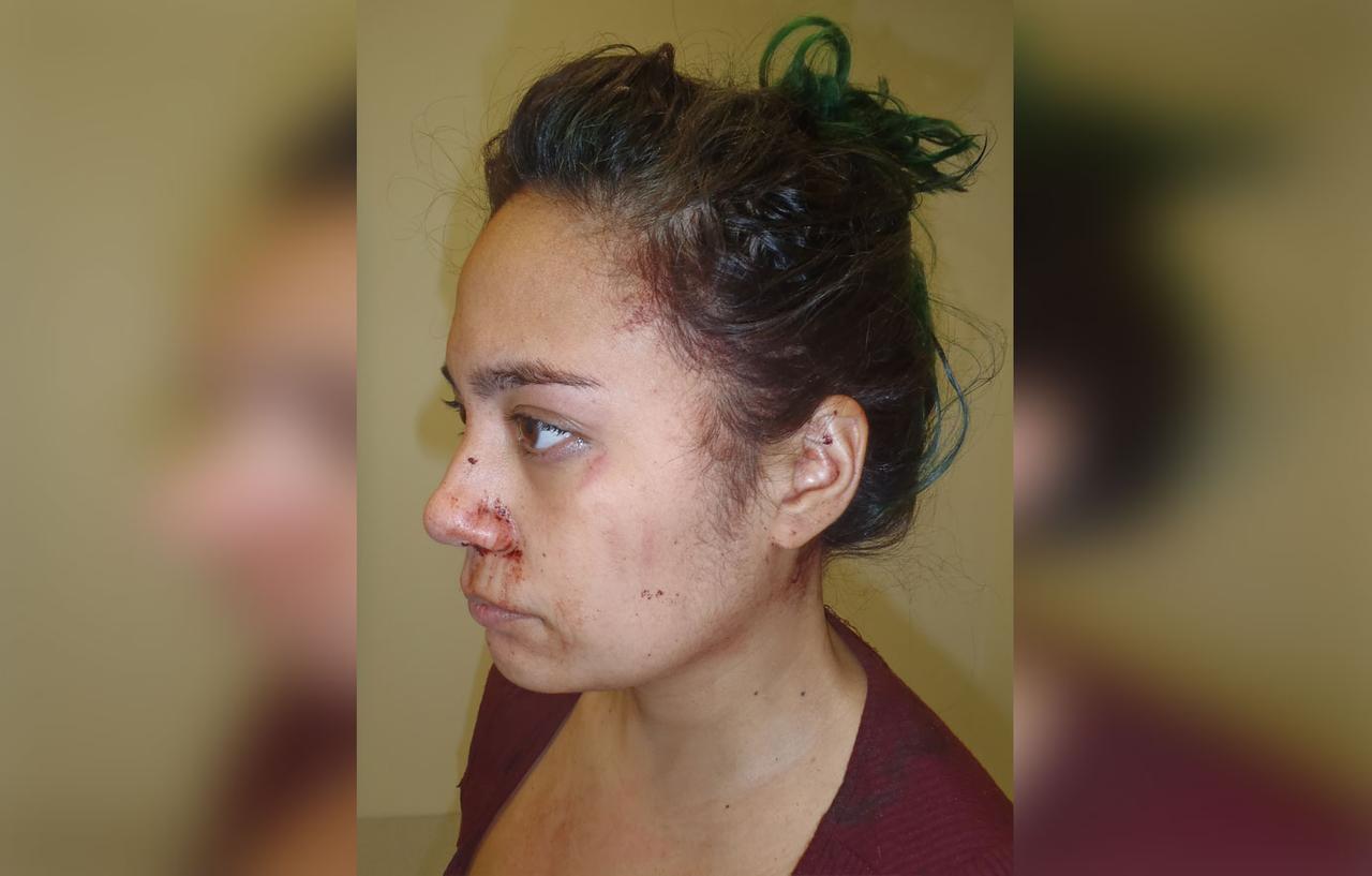 Woman Who Stabbed Her Boyfriend With A Samurai Sword Bloody Photos
