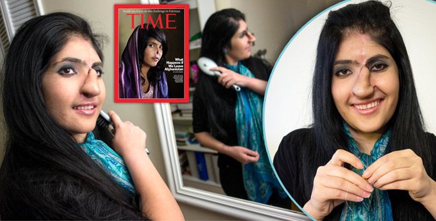 //afghan girl nose cut off taliban photos face transplant rex usatime magazine