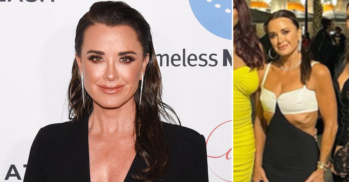 Kyle Richards' Fans Call For 'Intervention' After Freakishly Thin Pics  Emerge