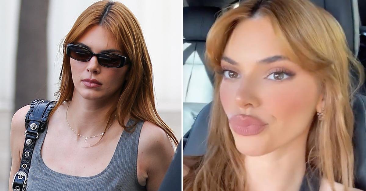Kendall Jenner Flaunts Shocking Plumped-Up Lips