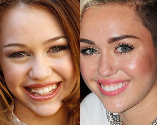 They May Be Beautiful But These Celebs Were Given A Bad Set Of Chompers