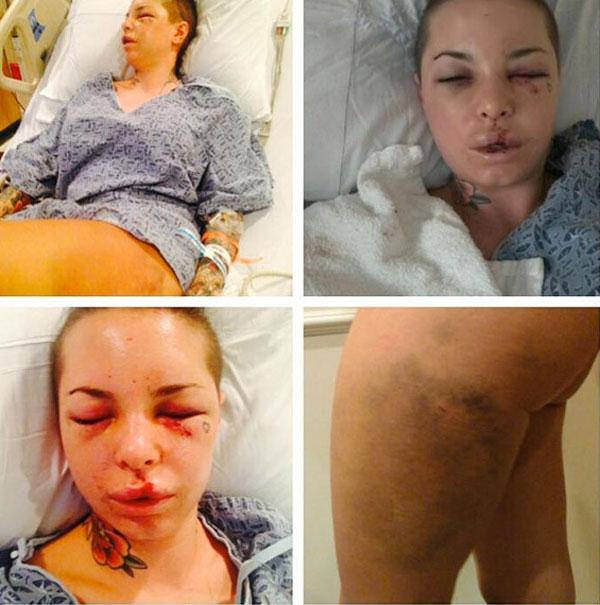 // christy mack injuries twitter