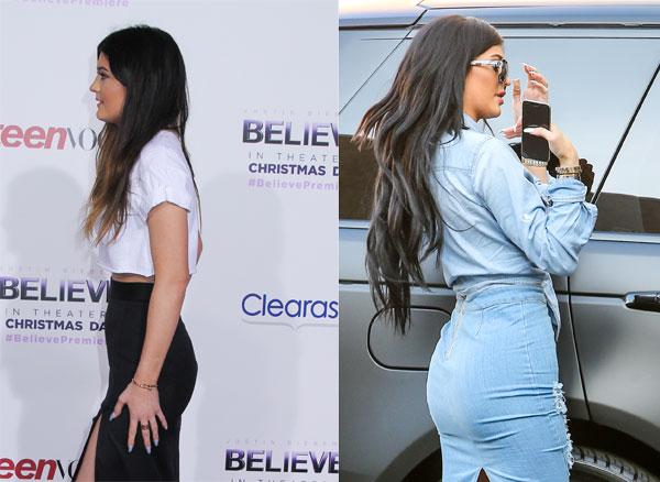 //kylie jenner plastic surgery top doctor estimates boob job face work extensions