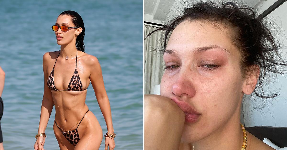 bella hadid bikini miami photos anxiety depression instagram crying meltdown