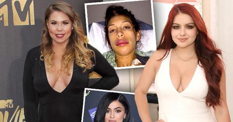 //kylie jenner brielle zolciak farrah abraham young stars plastic surgery pp