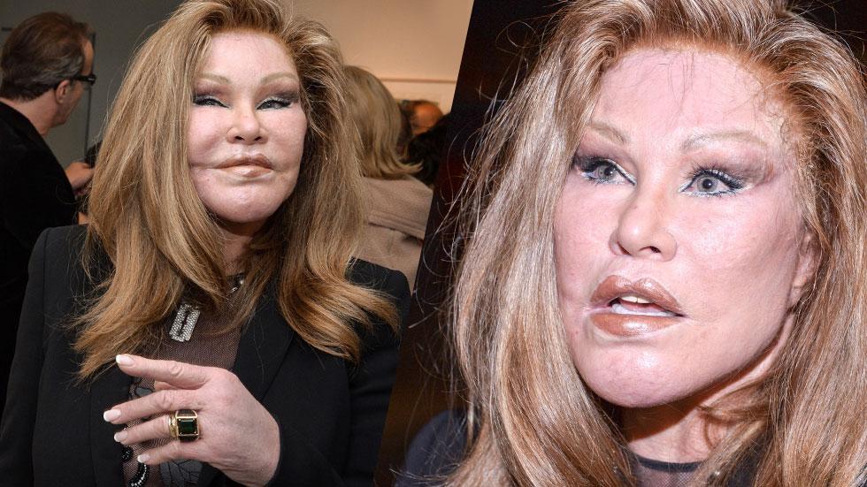 Jocelyn Wildenstein Plastic Surgery Photos