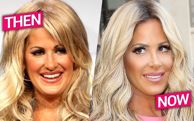 Kim Zolciak Nose Job