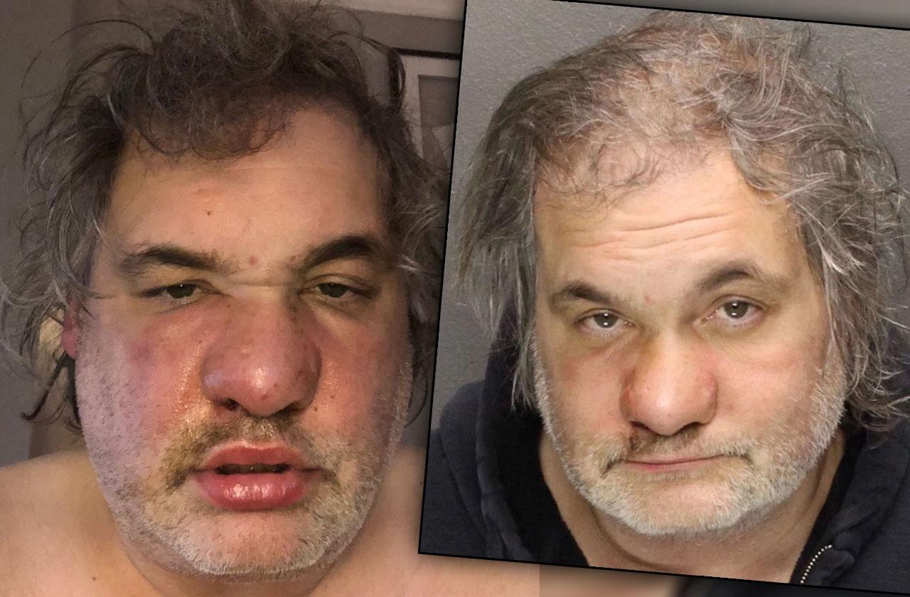 artie lange hospitalized