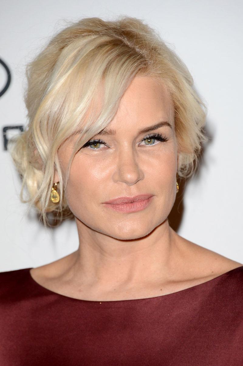 Yolanda Foster Plastic Surgery Botox Wrinkles