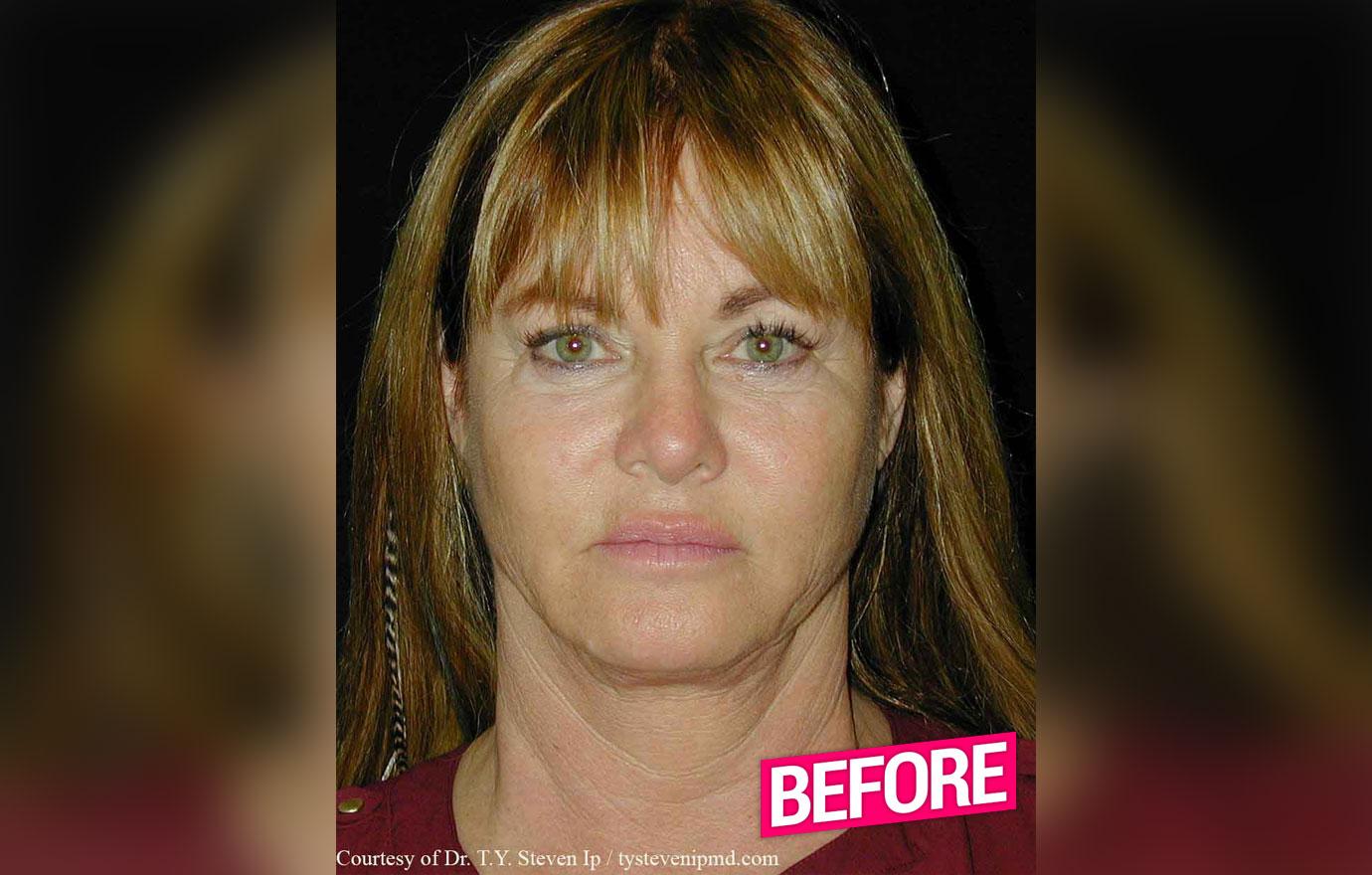 //rhoc Jeana Keough plastic surgery makeover