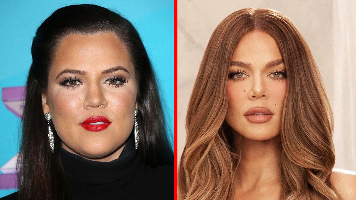 Dr. Youn suggested Kardashian was 'fairly natural' between 2008 and 2011.