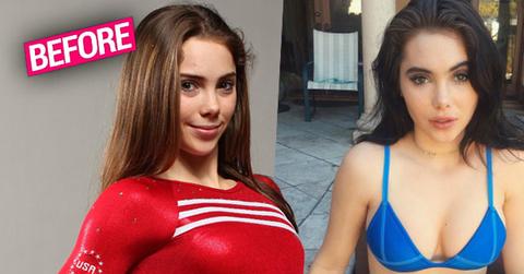 //mckayla maroney gymnast plastic surgery claims lip fillers boob job botox injections pp
