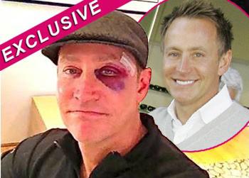 //peter marc jacobson black eye spl