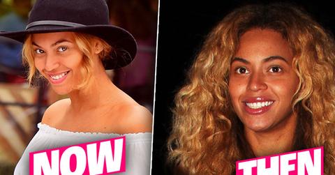 //beyonce nose job pp