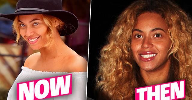 Pretty Hurts! Beyonce Has Secret Nose Job, Top Plastic Surgeons Reveal ...