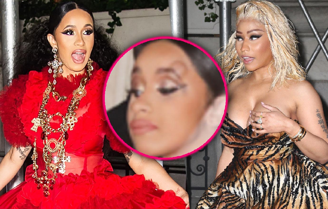 Cardi B Bump On Head Statement After Attacking Nicki Minaj