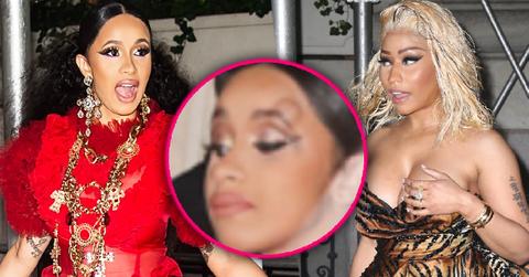 Cardi B Bump On Head Statement After Attacking Nicki Minaj