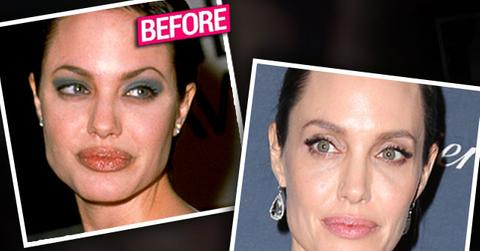 Angelina Jolie Nose Job