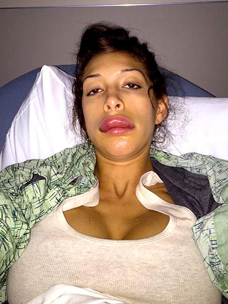 Jessica Rabbit wannabe spends £35k on plastic surgery to get the