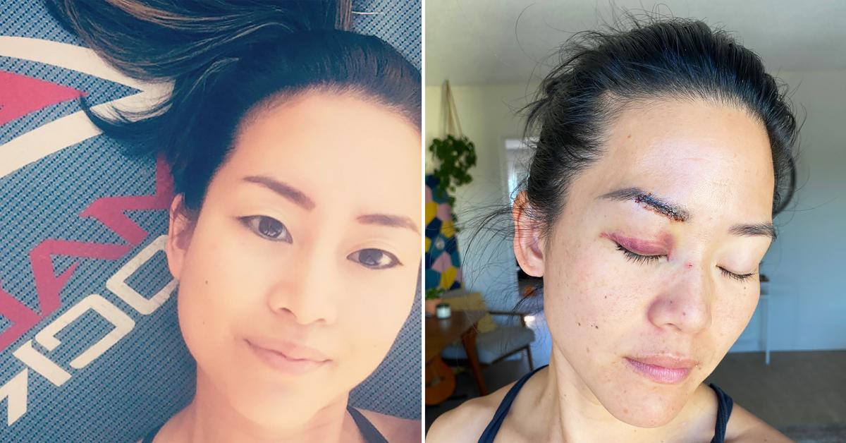 michelle yi survivor fiji stabbed beaten homeless woman santa monica r