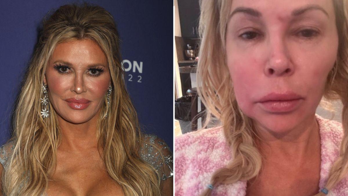 Brandi Glanville suffered an undiagnosed illness for years.