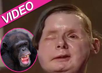 //charla nash chimp attack abclocal