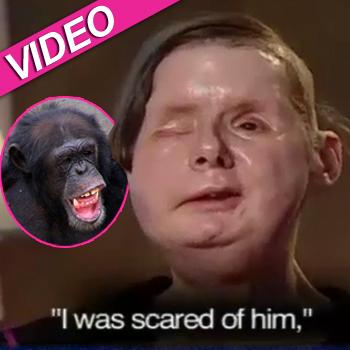 Blinded Chimp Attack Victim Charla Nash: ‘I Wouldn’t Mind Seeing What I