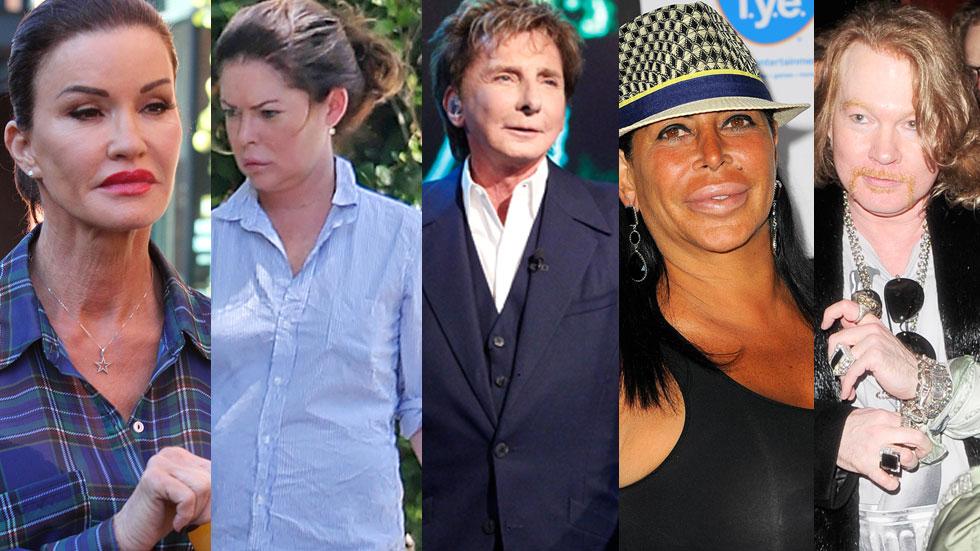 Updated! 21 Most SHOCKING Celebrity Plastic Surgery Transformations(04)