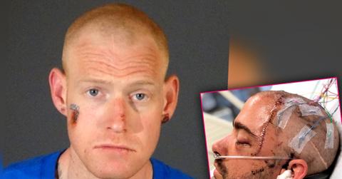 //redmond oneal stabbing victim years recovery disturbing photos PP