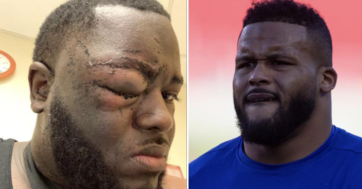 Man accuses Rams star Aaron Donald of assaulting him at Pittsburgh