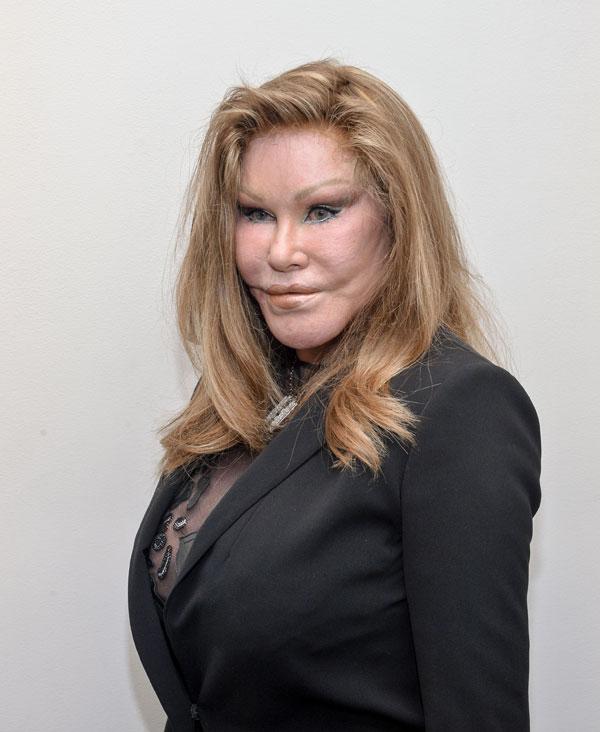 Jocelyn Wildenstein Plastic Surgery Photos