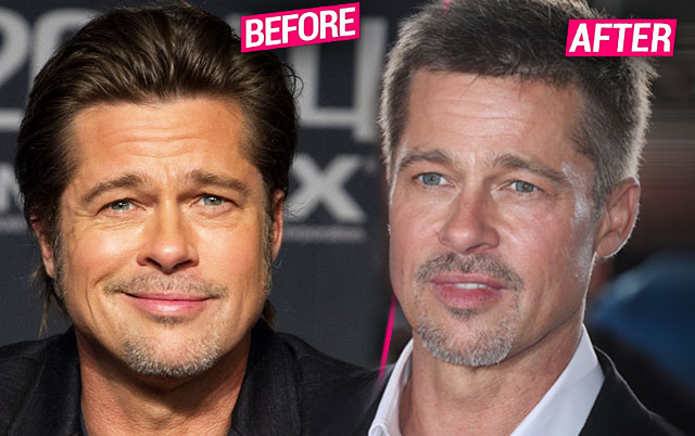 Revenge Facelift! Brad Pitt Has 'Fillers, Botox & Peels' In Wake Of ...