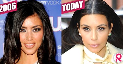 //kim kardashian hairline today wide