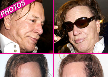 //mickey rourke plastic surgery