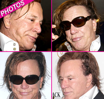 //mickey rourke plastic surgery