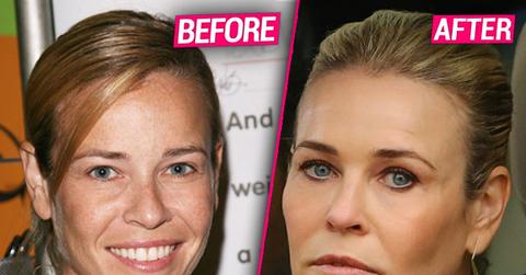 //chelsea handler plastic surgery rumors pp