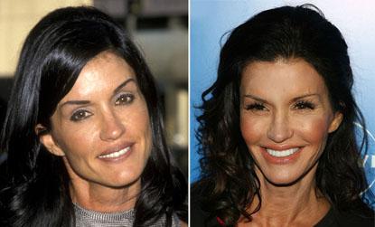 //janice dickinson addicted to plastic surgery