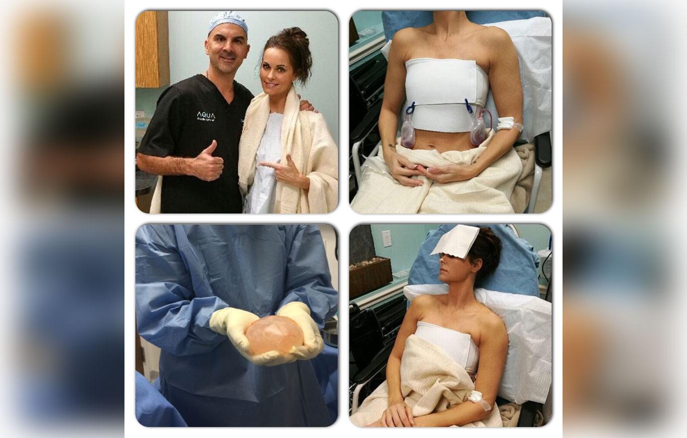 //Karen McDougal Breast Implant Surgery