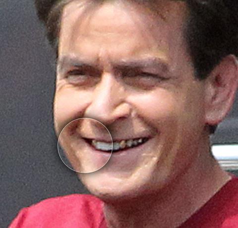 Charlie's Skin Appears To Show His Struggle With Deadly Disease