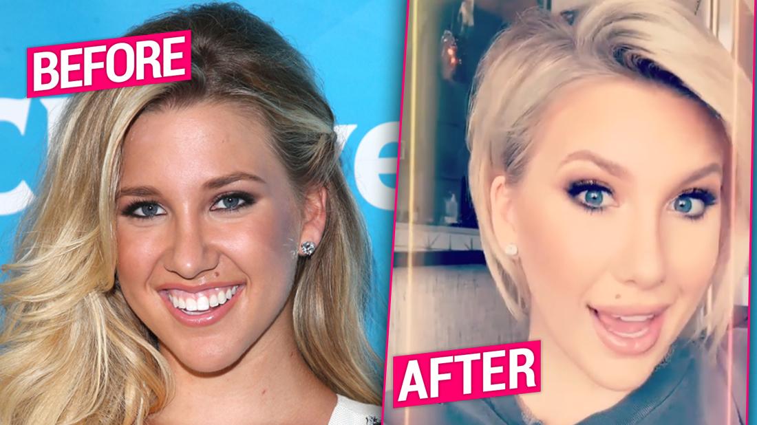 Savannah Chrisley Nose Job.