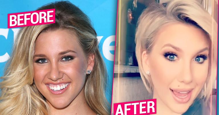 Savannah Chrisley Plastic Surgery Makeover Exposed