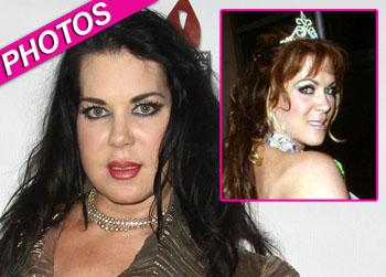 //chyna plastic surgery wenn