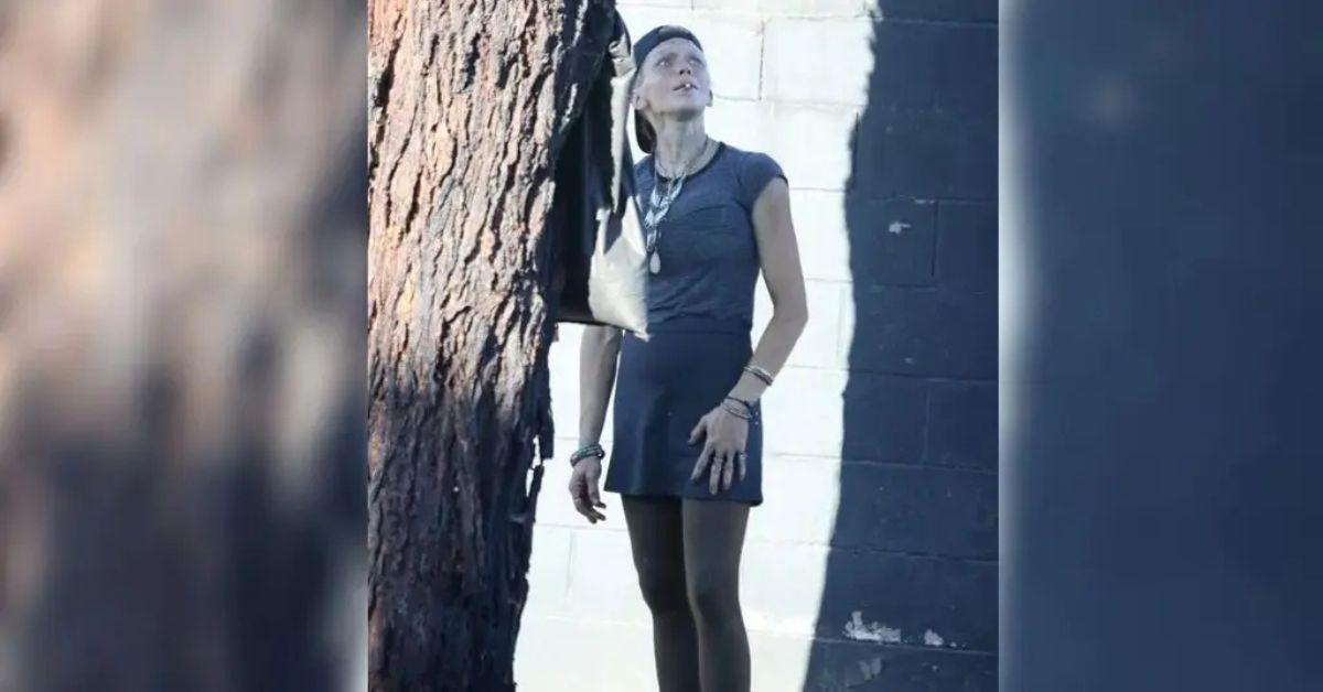 loni willison tragic fall what happened ex model