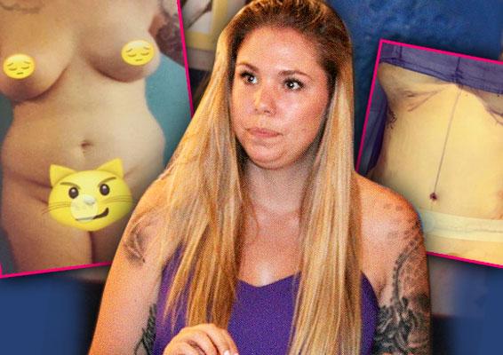 //kailyn lowry plastic surgery pain meds