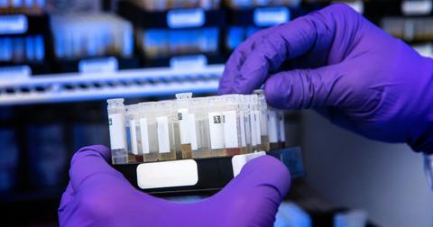 biden harris administration admit closely monitoring mpox infections unsplash